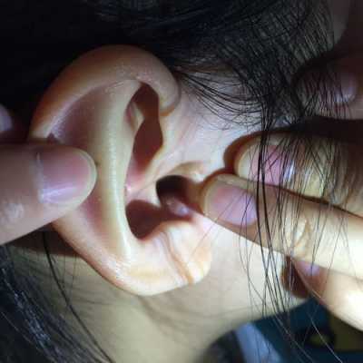 淋巴结肿大耳朵里面痒是什么原因 耳朵里面痒是什么原因