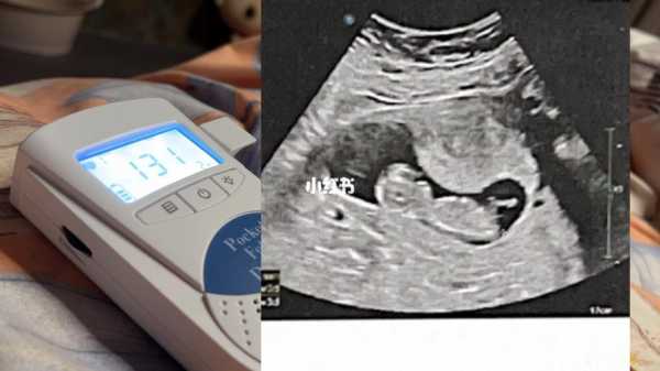  胎儿心跳快是什么原因「胎儿心跳加快应该怎么办」